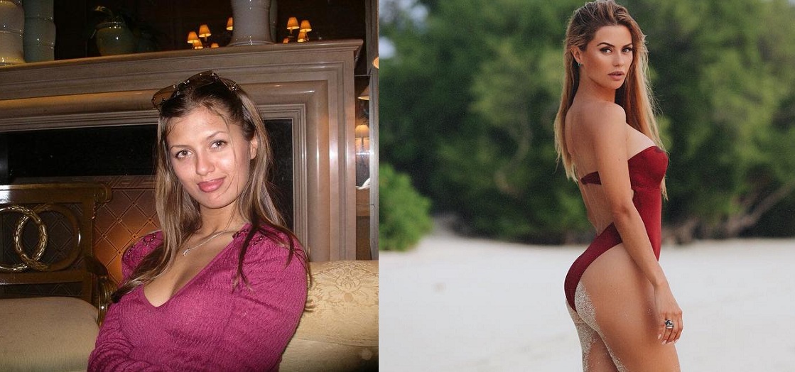 Варвина до и после пластики фото